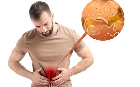 The Hidden Threat: How Parasitic Infections Affect Your Health