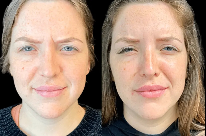 How to Choose the Best Aesthetic Clinic in Dubai for Your Skin Goals